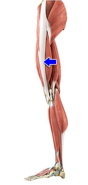 Treating Iliotibial Band Syndrome in Plano, Frisco, McKinney and Allen